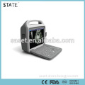 hot sale hospital and clinical protable ultrasonic diagnostic devices
